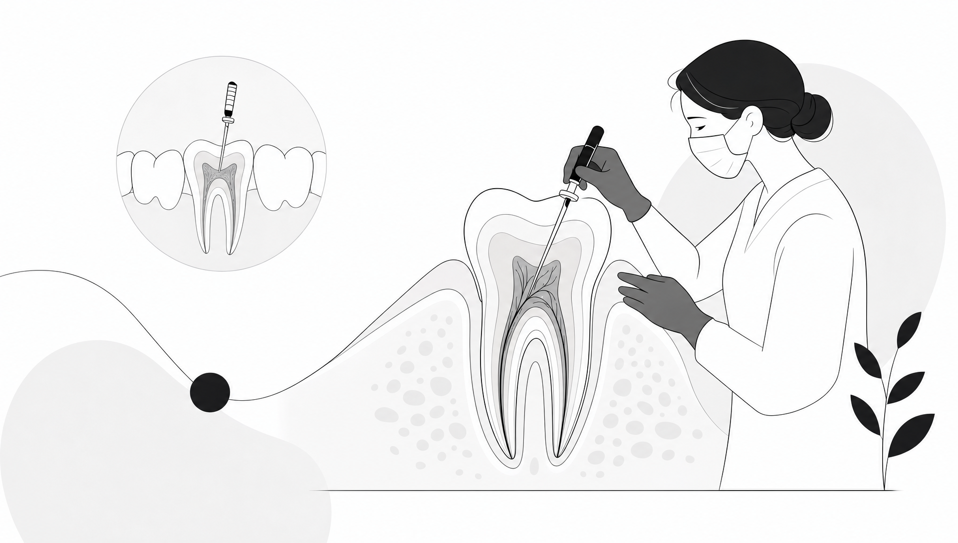 8 Signs You May Need a Root Canal - Main Image