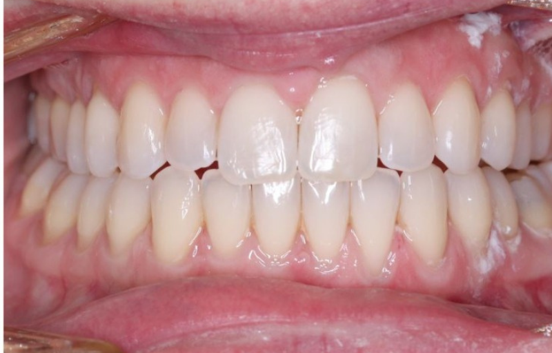 After (Dr Richard Bui's Case)