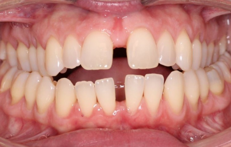 Before (Dr Richard Bui's Case)