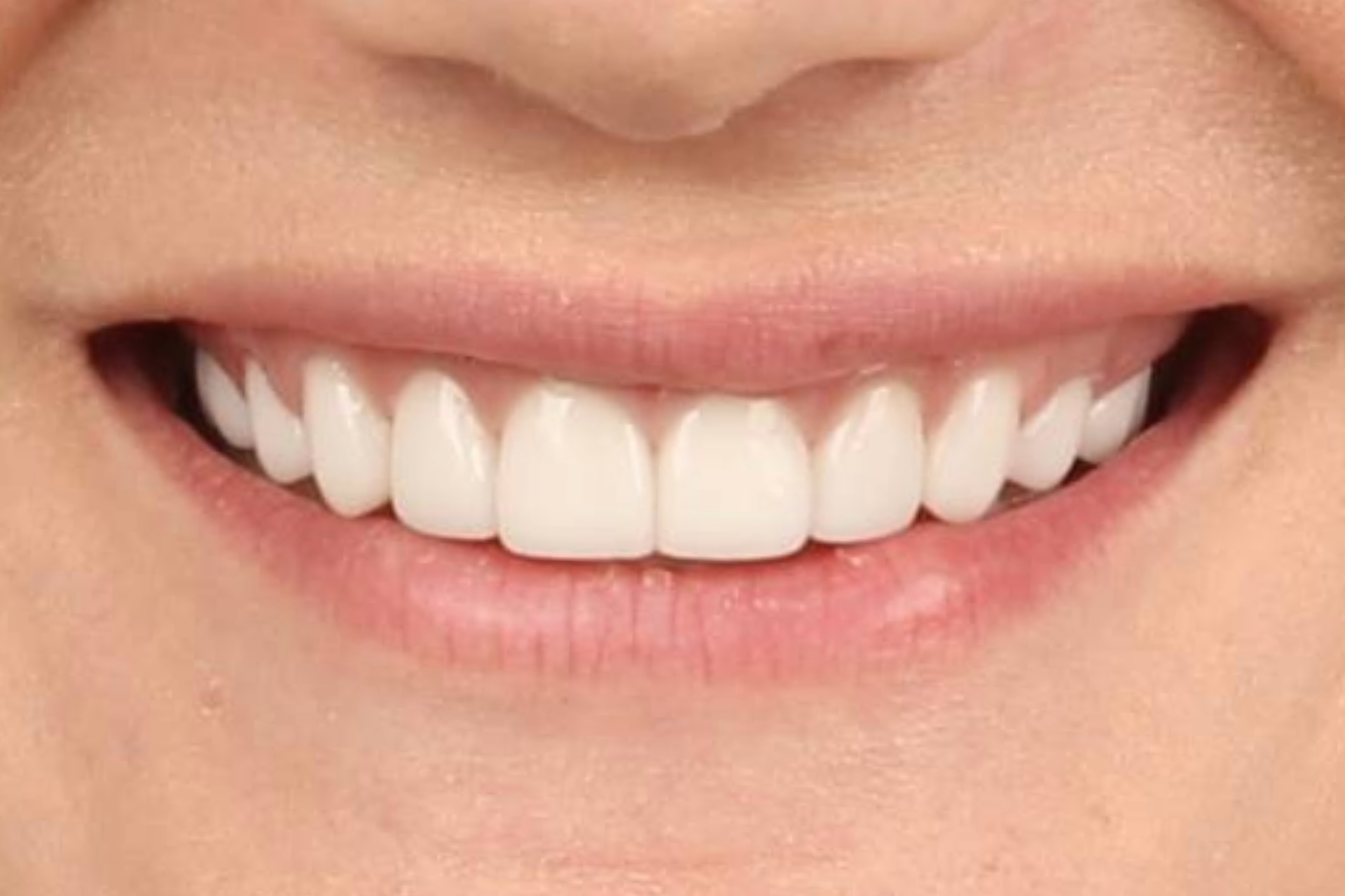 Metro Dental Invisalign Metro Dental Invisalign