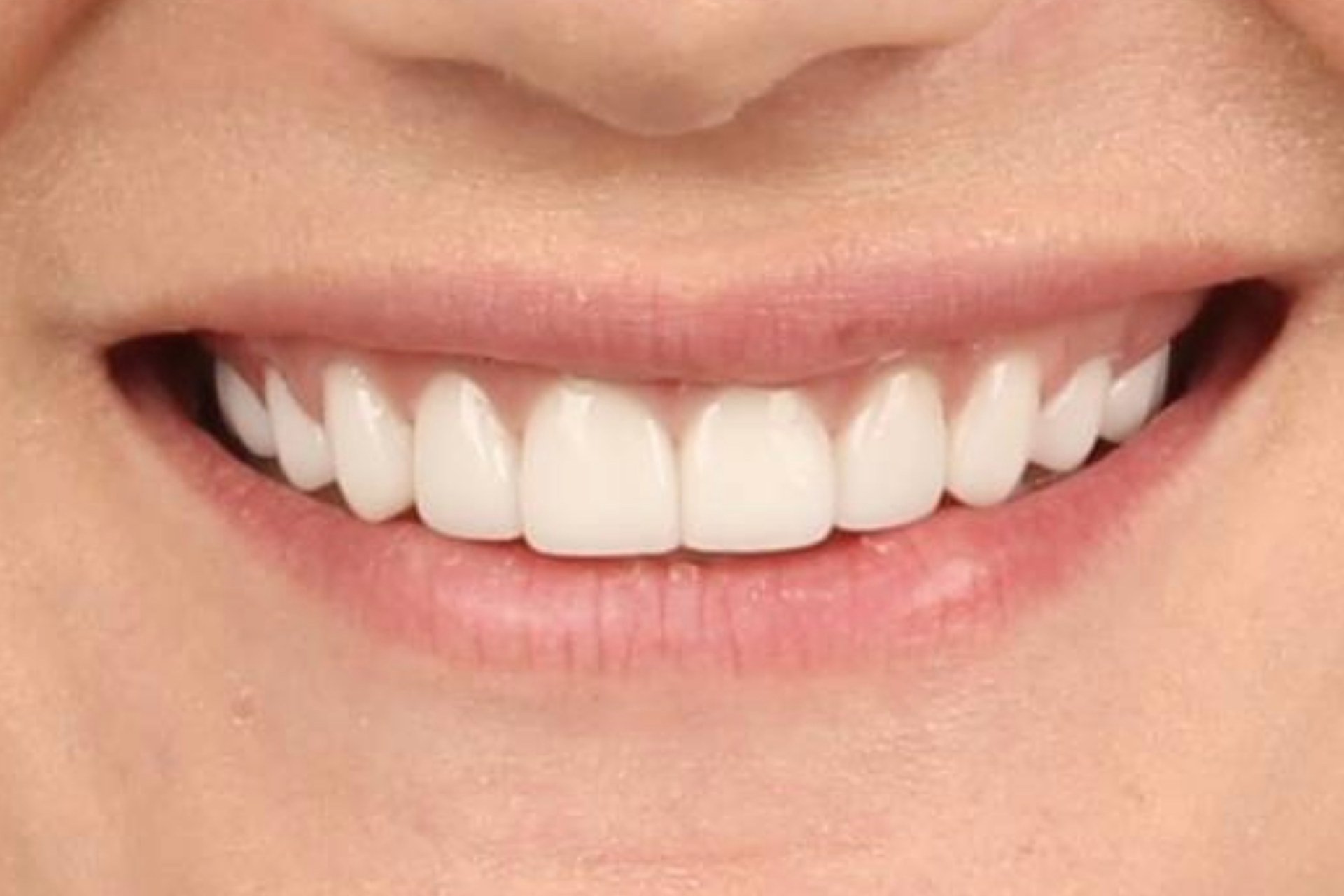 Melbourne Invisalign