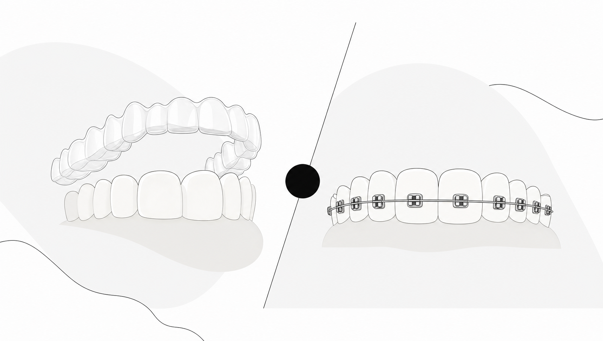 Invisalign vs Braces: Which Is Right for Your Smile?
